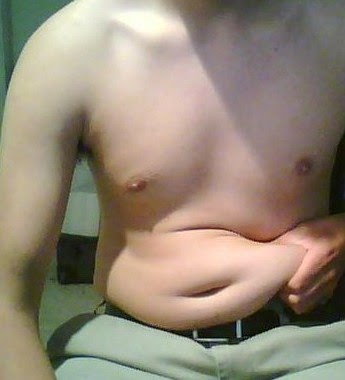 Excess_human_adipose_tissue