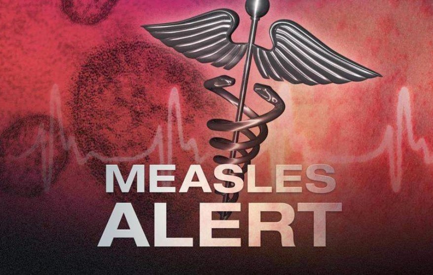 measles_modelbase_detail_web