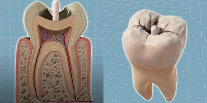 tooth-main