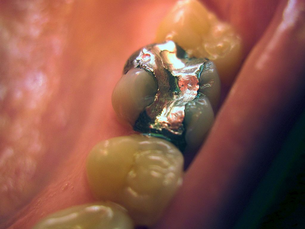 1024px-Filling