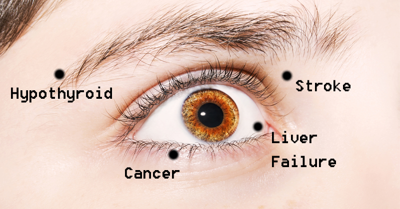 eye-health-FI eye-health-FI