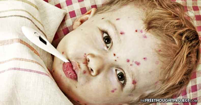 School Bans Unvaccinated Kids After Immunized Children Start Chickenpox Outbreak