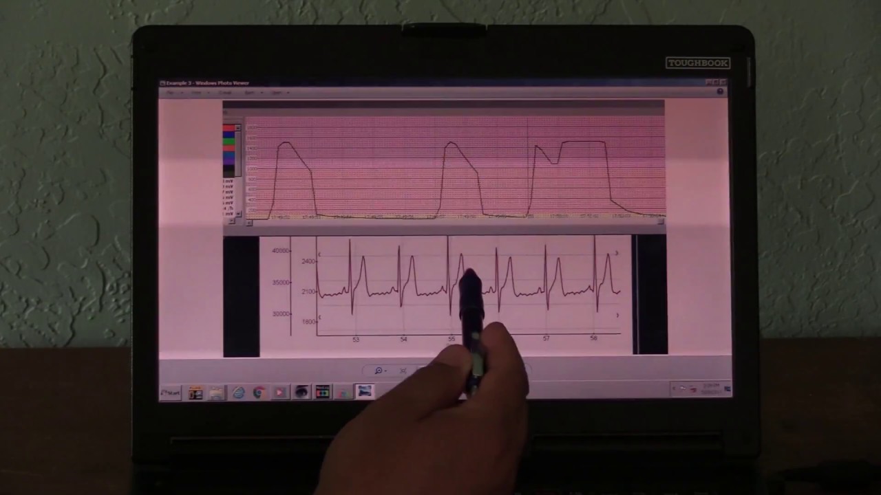 Can—And Do—Utility Smart Meters Affect the Human Heart?