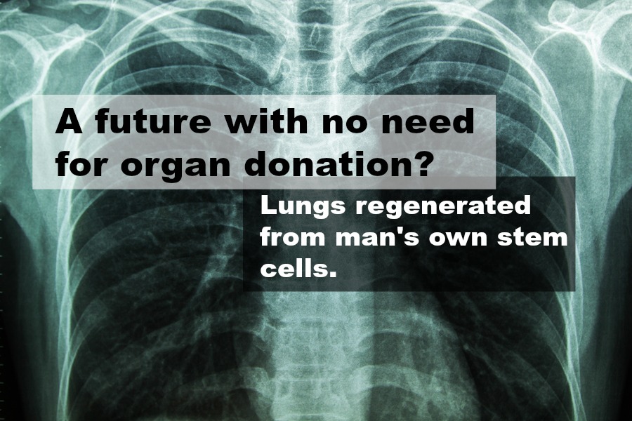 X-Ray Image Of Human Chest for a medical diagnosis