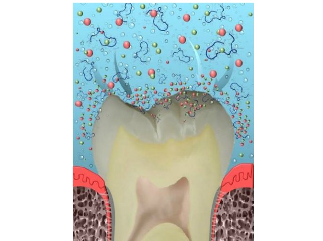 prevent dental cavaties prevent dental cavaties