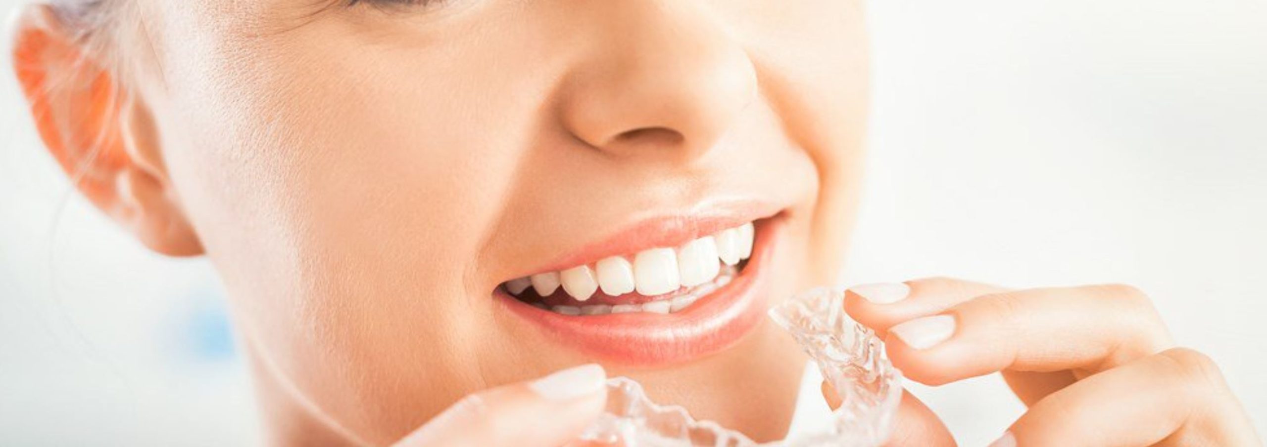 braces alternative braces alternative