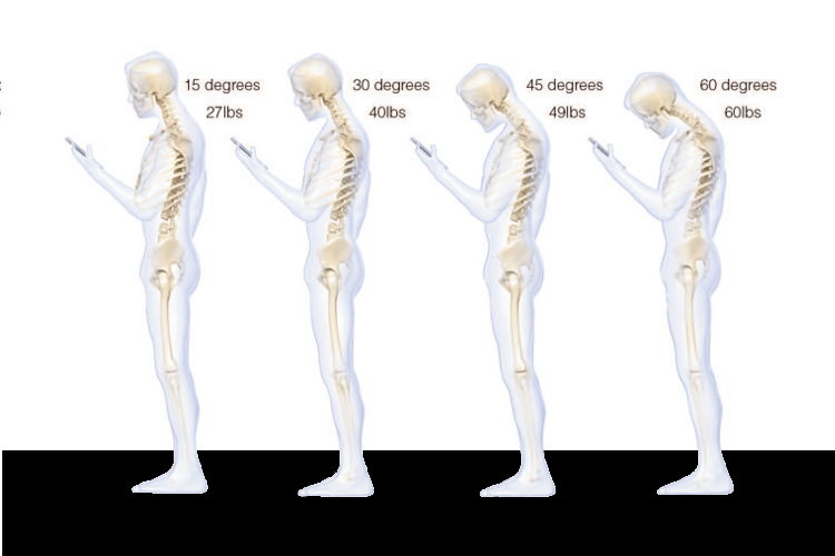 neckstress2 neckstress2