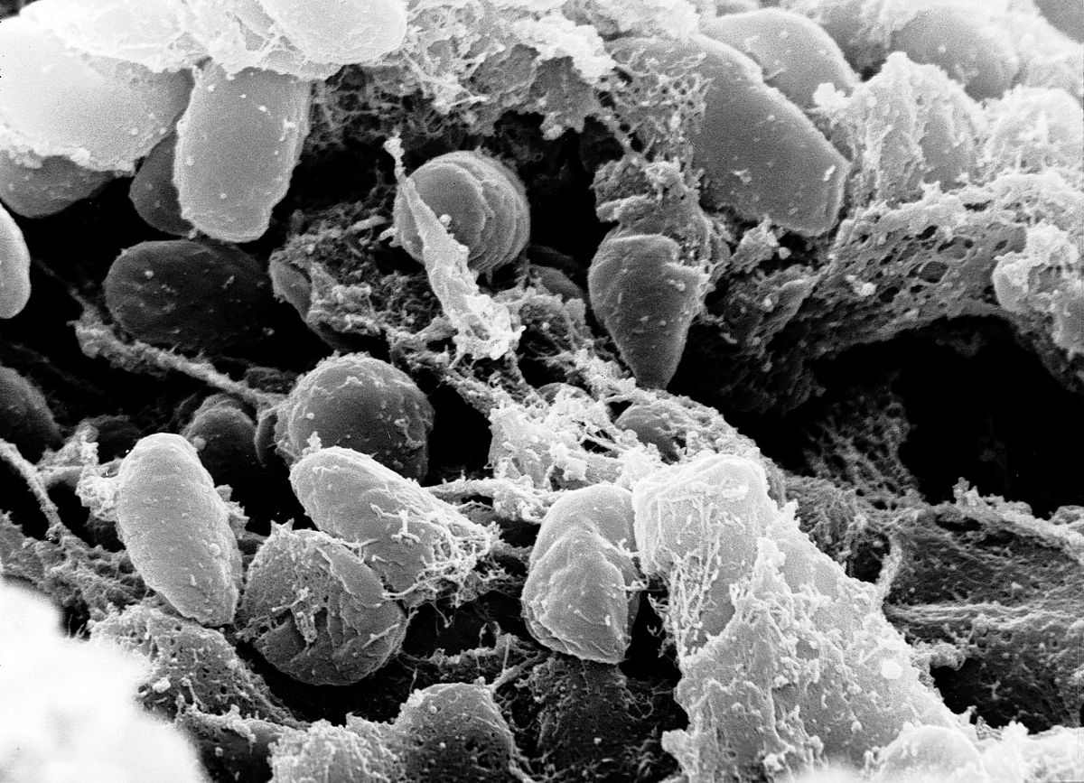 1200px-Yersinia_pestis 1200px-Yersinia_pestis