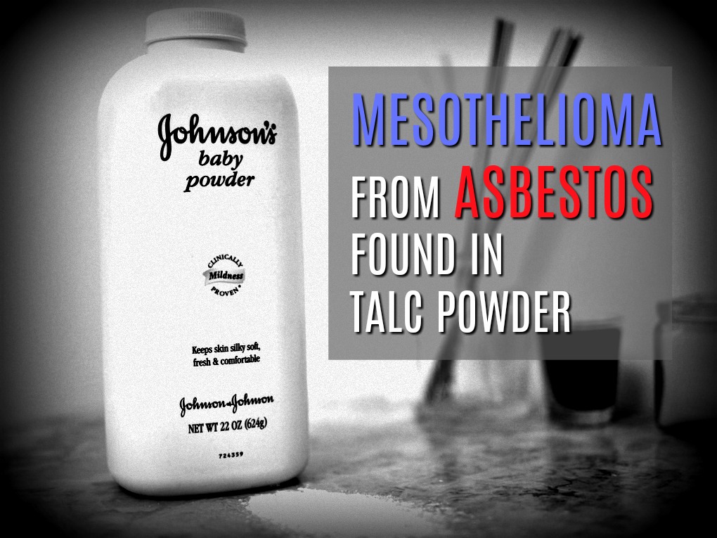 mesothelioma asbestos talc