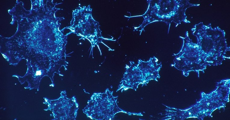 israeli-scientists-complete-cure-for-cancer israeli-scientists-complete-cure-for-cancer