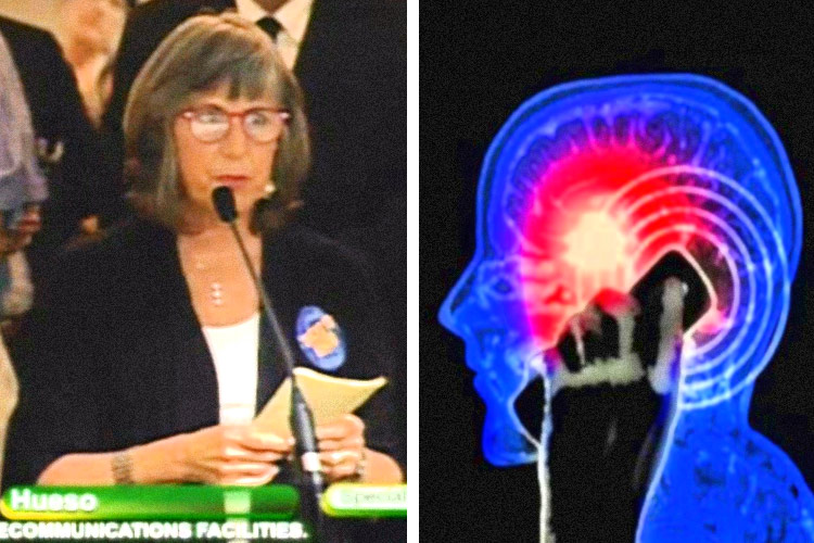 Cell-Phone-Brain-Tumor-Association