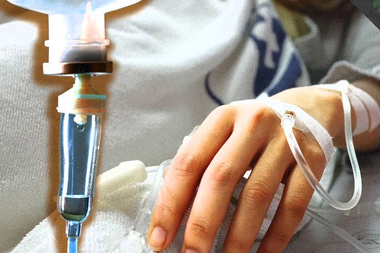 Chemotherapy
