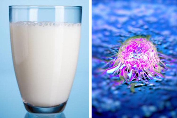 Milk-and-Cancer Milk-and-Cancer