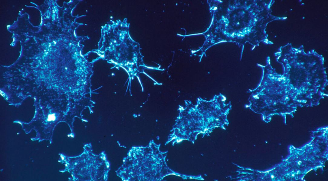 cancer cells tmu cancer cells tmu