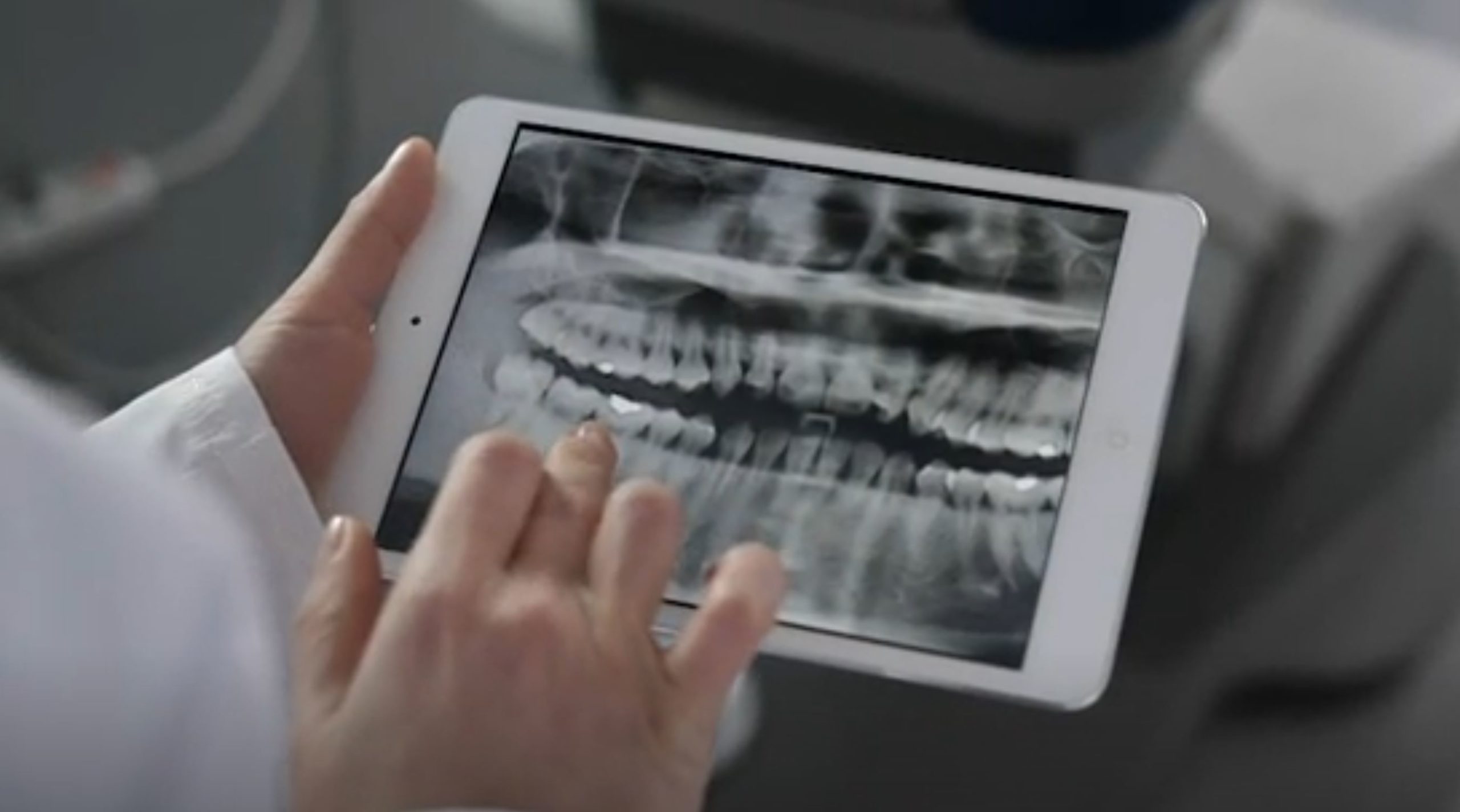 fluoride dental fluoride dental