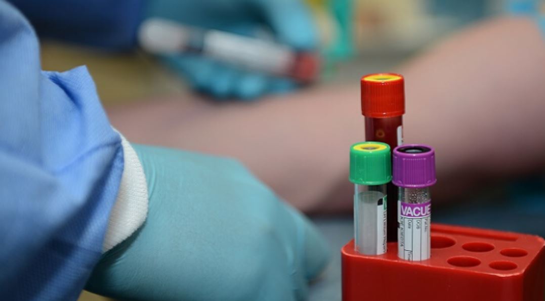 coronavirus testing