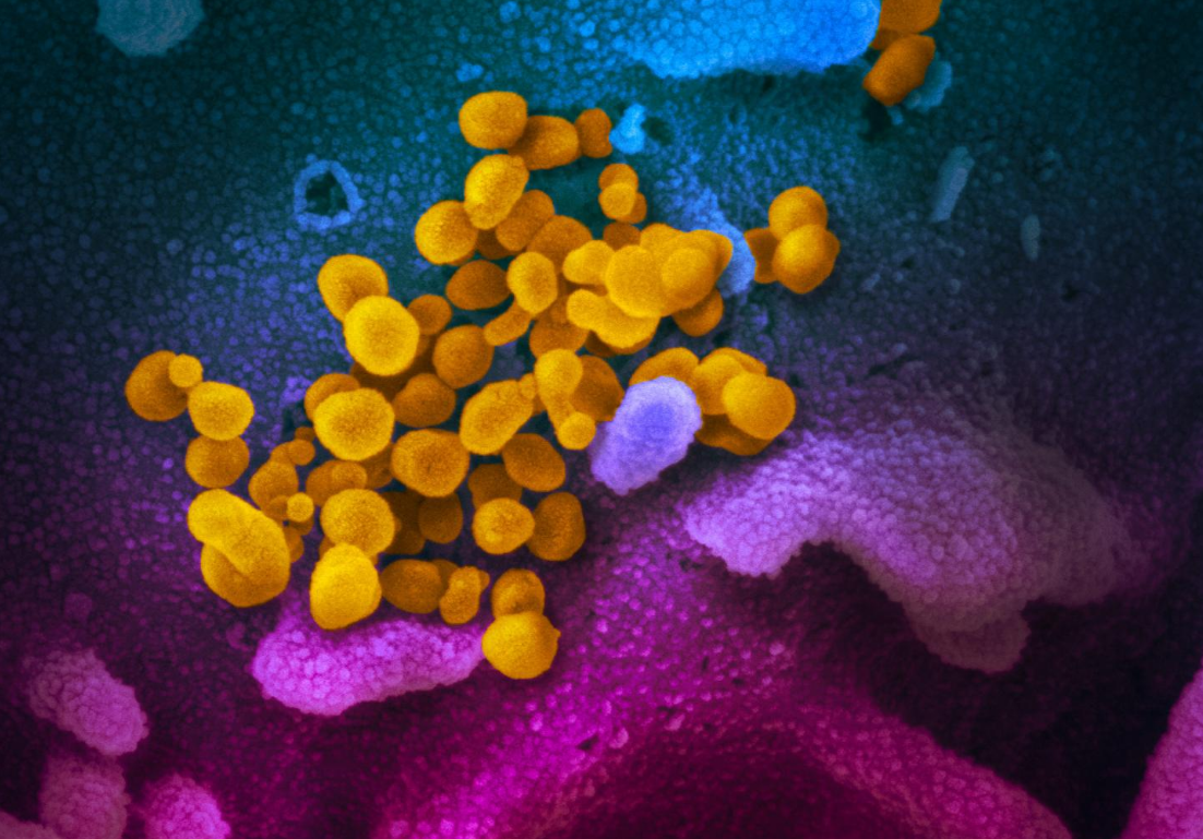 sars_coronavirus sars_coronavirus