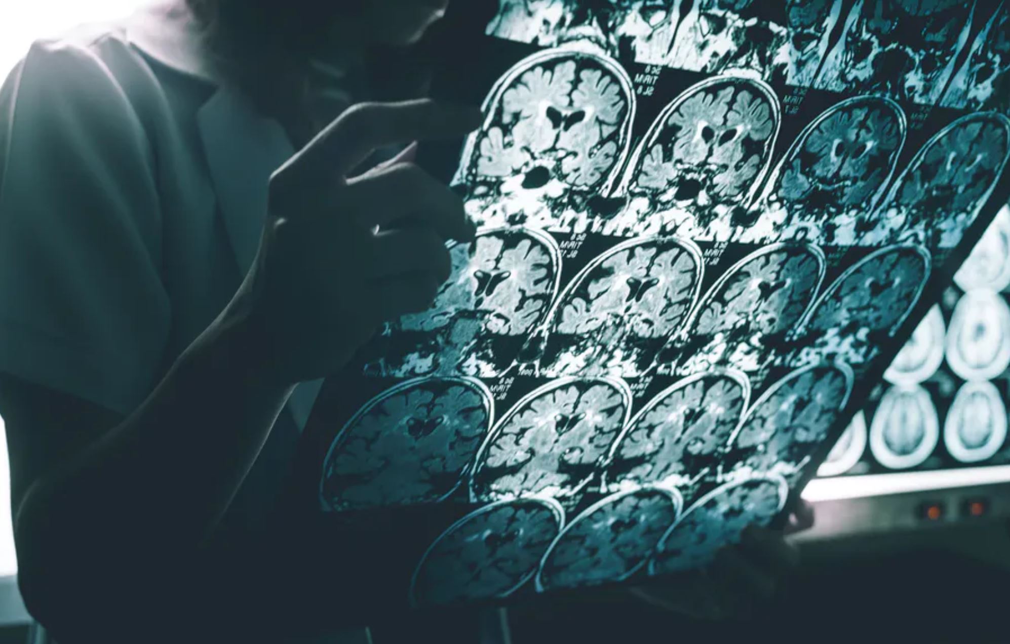 alz obesity conversation