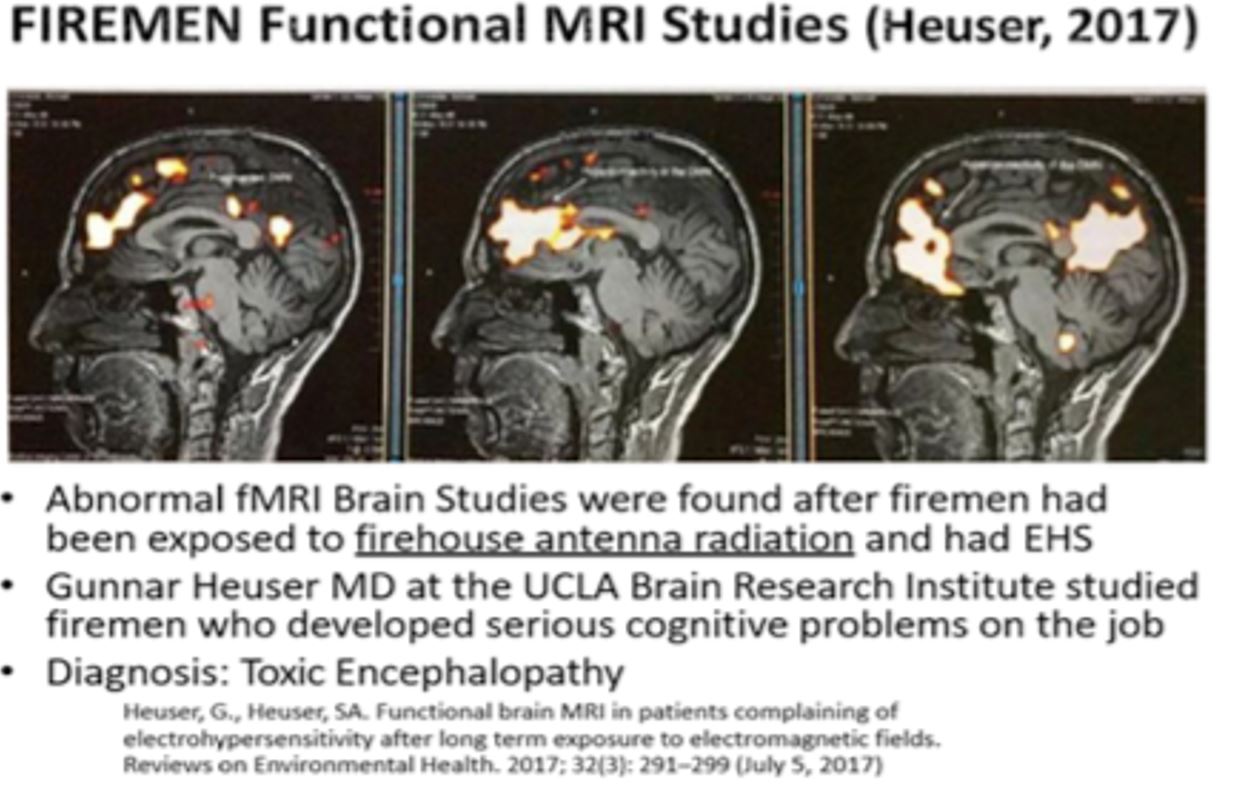 firemen mri firemen mri