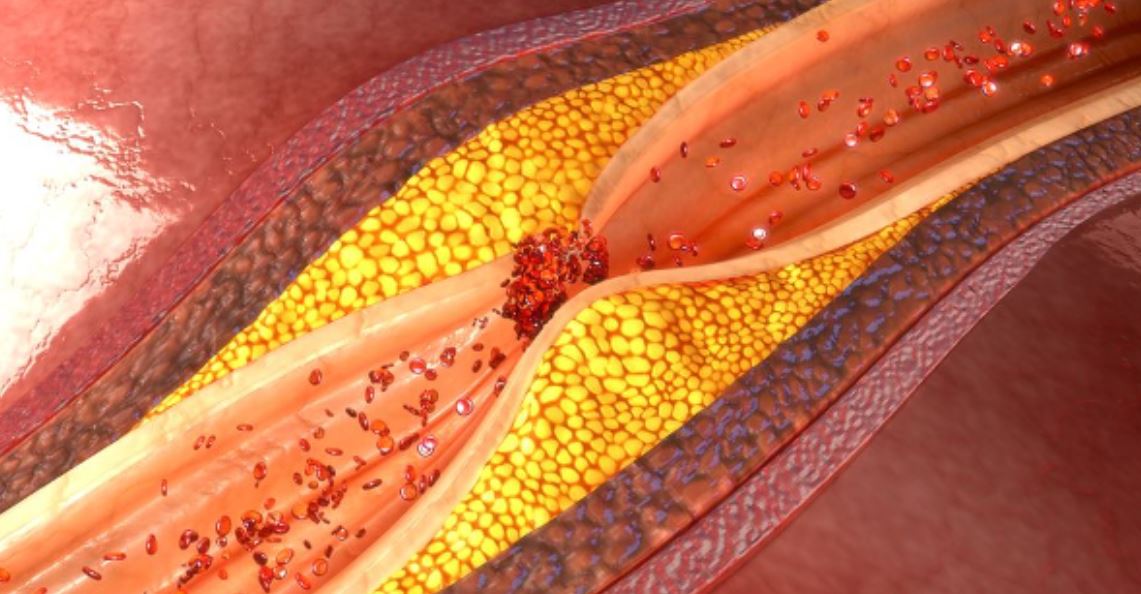 garlic arteries gmi garlic arteries gmi