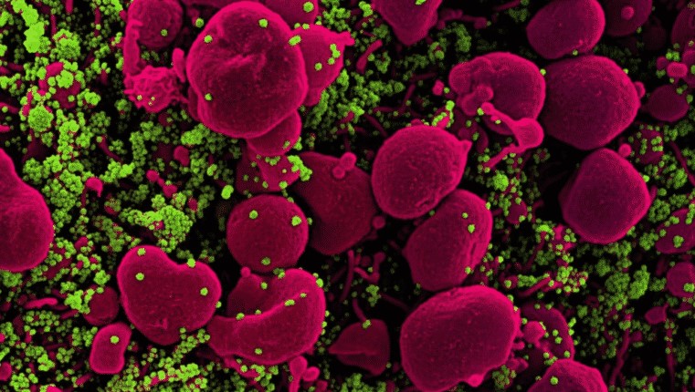 global pandemic global pandemic