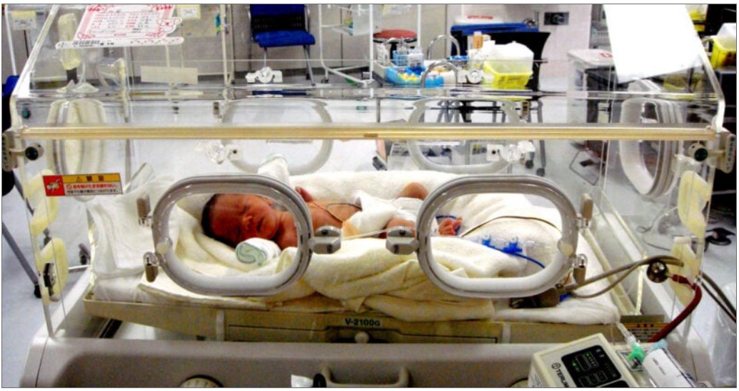 neonatal neonatal