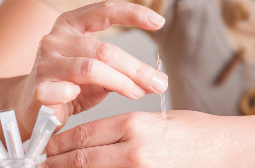 acupuncture greenmed