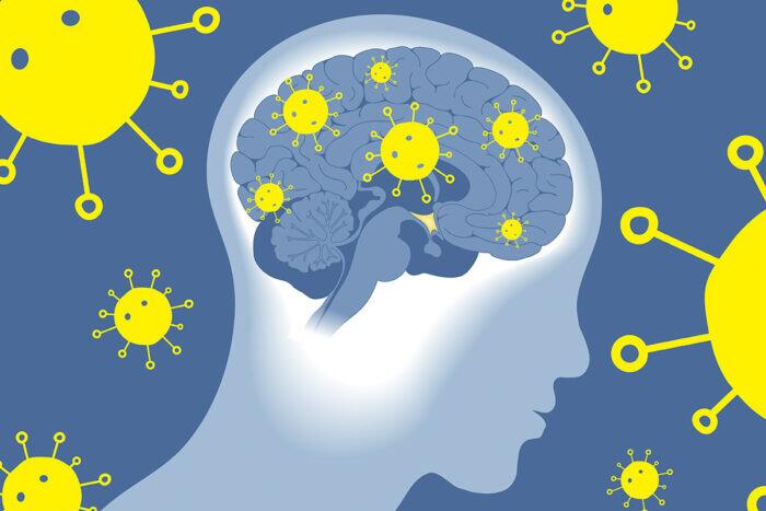 Long-Covid-Brain-opening-image-1-700x467_jpg_92