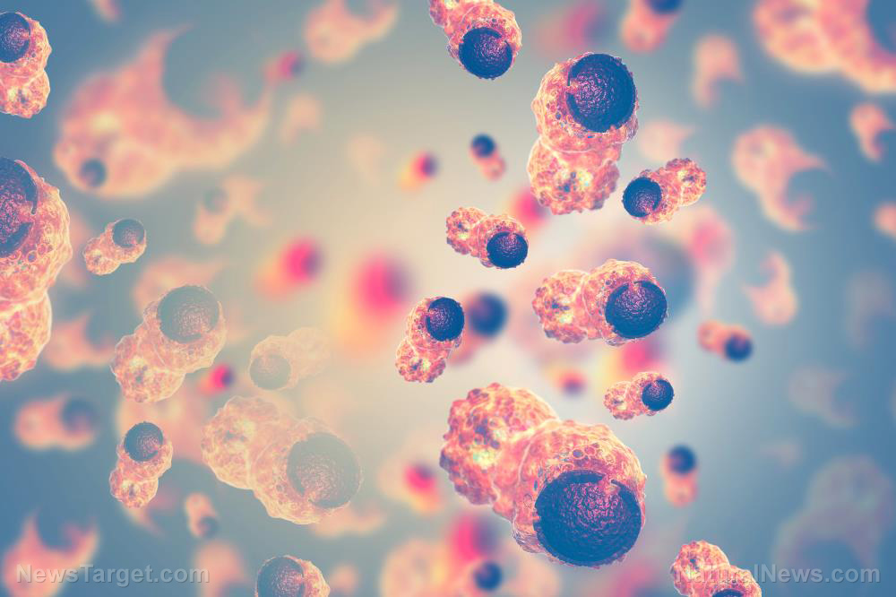 Cancer-Pathology-Tumour-Disease-Dna-Growth-Human Cancer-Pathology-Tumour-Disease-Dna-Growth-Human