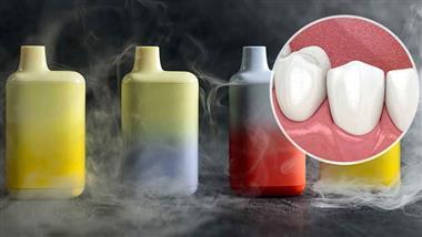 vaping-and-gum-health