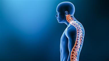 curved-back-kyphosis