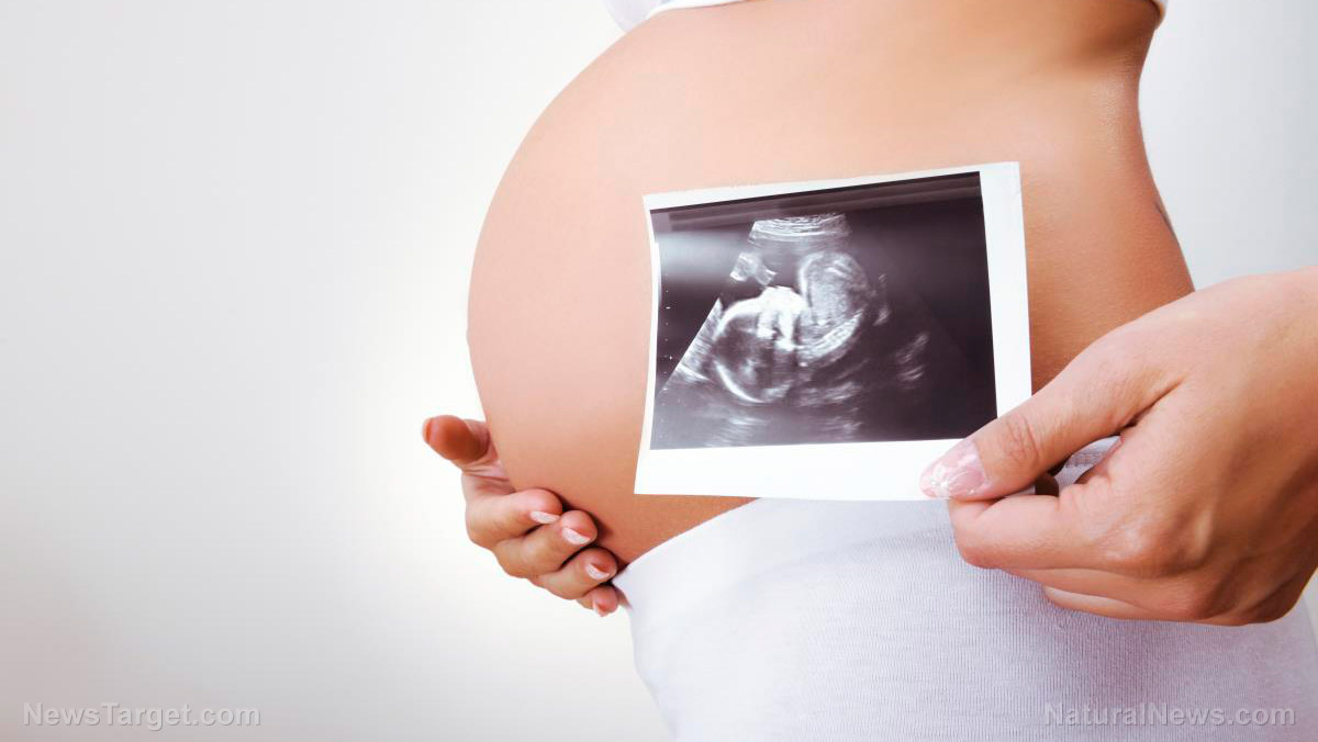 Woman-Pregnant-Ultrasound-Picture-Stomach