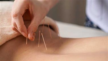 acupuncture-for-chronic-low-back-pain-thumbnail