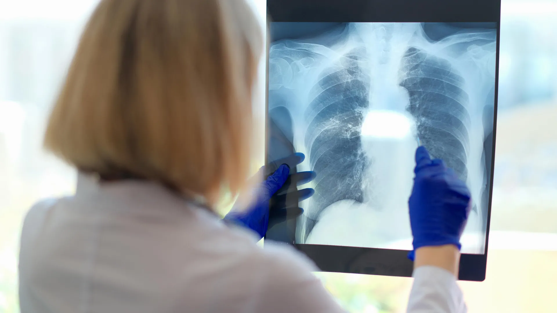 doctor-examines-lung-x-ray doctor-examines-lung-x-ray